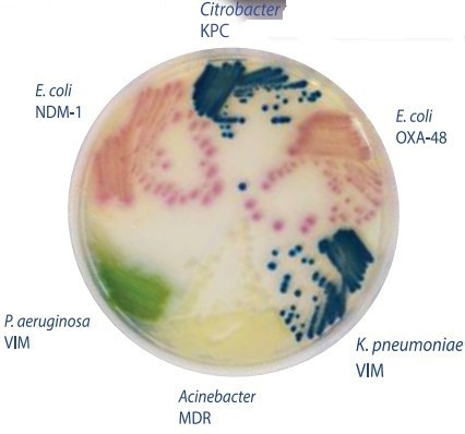 Hylabs̼��ùϩ���ˎ�c�U����CRE���z�y(c��)��֬���B(y��ng)��